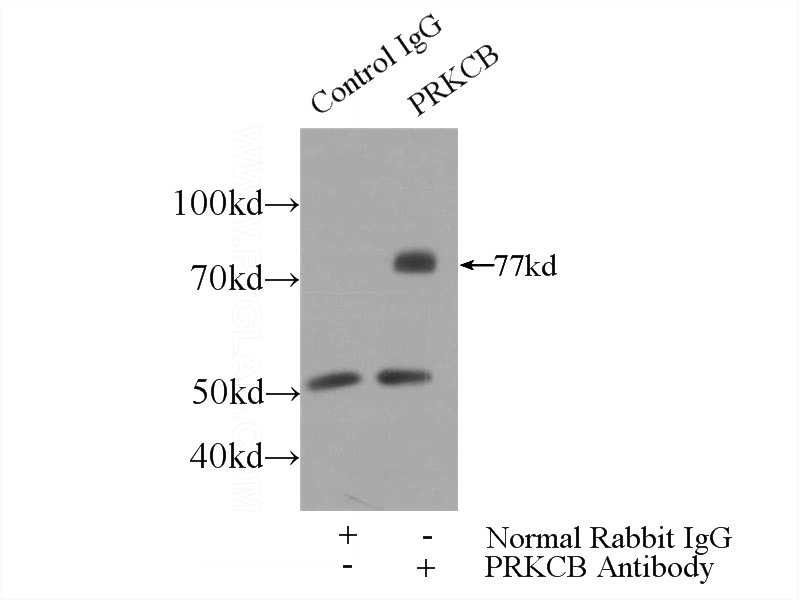 IP Result of anti-PRKCB (IP:Catalog No:113847, 3ug; Detection:Catalog No:113847 1:1000) with mouse brain tissue lysate 4000ug.