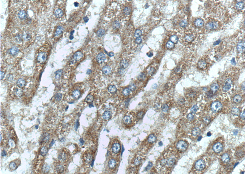 Immunohistochemistry of paraffin-embedded human liver tissue slide using Catalog No:113942(PLG Antibody) at dilution of 1:200 (under 40x lens).