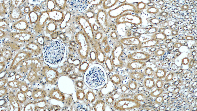 Immunohistochemistry of paraffin-embedded human kidney slide using Catalog No:116625(UPF1 Antibody) at dilution of 1:50
