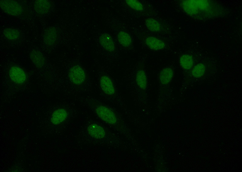 Immunofluorescent analysis of (-20oc Ethanol) fixed SKOV-3 cells using Catalog No:110491(EVI1 Antibody) at dilution of 1:50 and Alexa Fluor 488-congugated AffiniPure Goat Anti-Rabbit IgG(H+L)