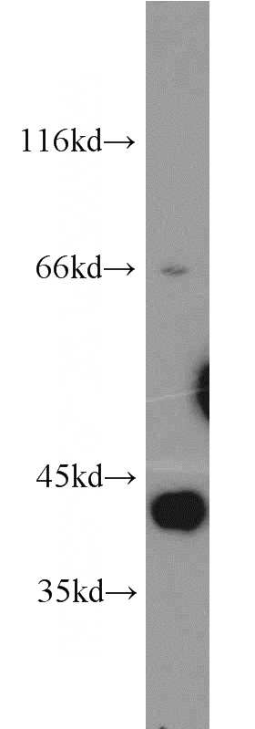 mouse brain tissue were subjected to SDS PAGE followed by western blot with Catalog No:113593(PARP2 antibody) at dilution of 1:600