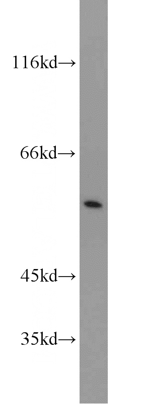 MCF7 cells were subjected to SDS PAGE followed by western blot with Catalog No:115915(TCP1 antibody) at dilution of 1:1000