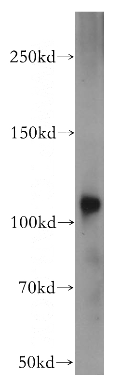 mouse kidney tissue were subjected to SDS PAGE followed by western blot with Catalog No:109047(PROM1 antibody) at dilution of 1:500