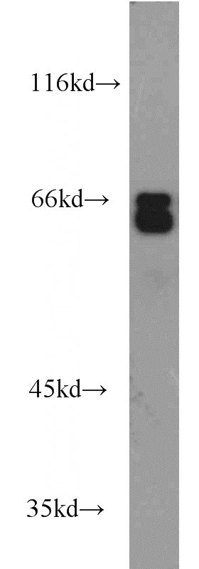 Jurkat cells were subjected to SDS PAGE followed by western blot with Catalog No:112922(MYEF2 antibody) at dilution of 1:2000