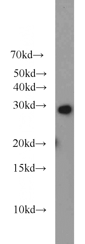 mouse brain tissue were subjected to SDS PAGE followed by western blot with Catalog No:114707(RIMS4-Specific antibody) at dilution of 1:1000