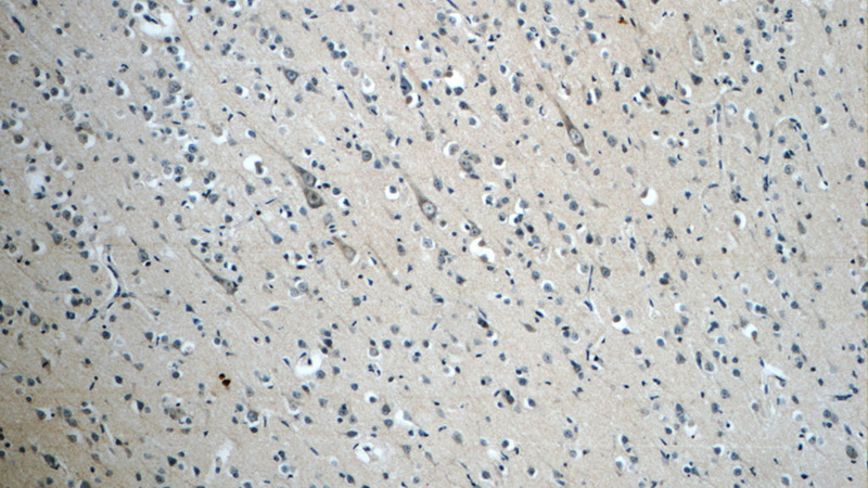 Immunohistochemistry of paraffin-embedded human brain slide using Catalog No:113330(OFD1 Antibody) at dilution of 1:50. (under 10x lens)
