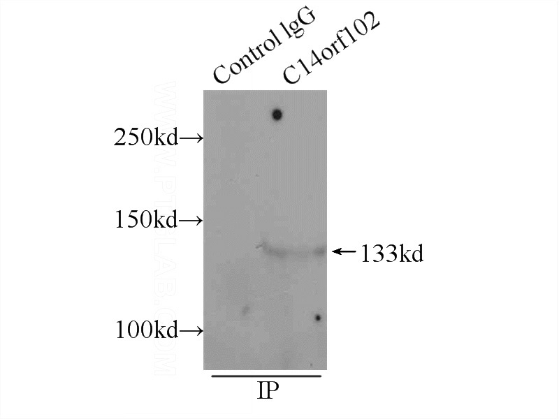 IP Result of anti-C14orf102 (IP:Catalog No:108656, 5ug; Detection:Catalog No:108656 1:500) with MCF-7 cells lysate 1200ug.