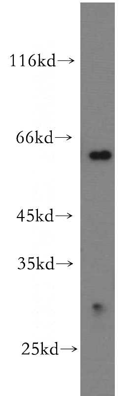 mouse brain tissue were subjected to SDS PAGE followed by western blot with Catalog No:111914(KATNA1 antibody) at dilution of 1:500