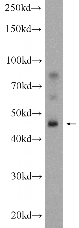 mouse liver tissue were subjected to SDS PAGE followed by western blot with Catalog No:110062(DPEP1 Antibody) at dilution of 1:300