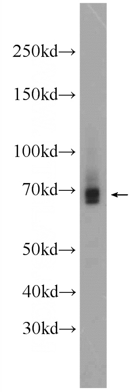 L02 cells were subjected to SDS PAGE followed by western blot with Catalog No:107920(AIRE Antibody) at dilution of 1:1000