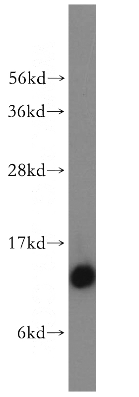 human heart tissue were subjected to SDS PAGE followed by western blot with Catalog No:113084(NDUFS6 antibody) at dilution of 1:500