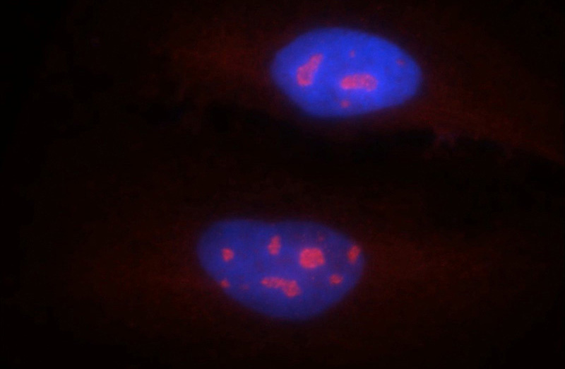 Immunofluorescent analysis of A549 cells using Catalog No:111477(HMGA2 Antibody) at dilution of 1:25 and Rhodamine-Goat anti-Rabbit IgG