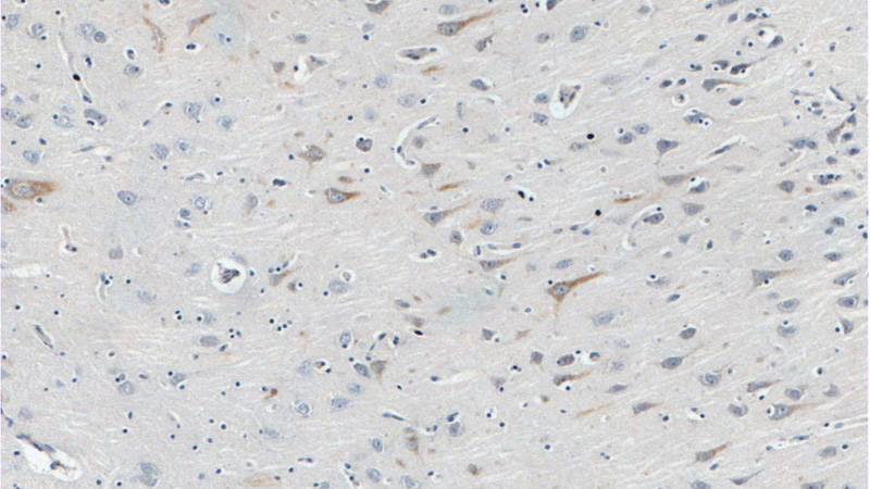 Immunohistochemistry of paraffin-embedded human brain tissue slide using Catalog No:111070(QRFPR Antibody) at dilution of 1:100 (under 10x lens).