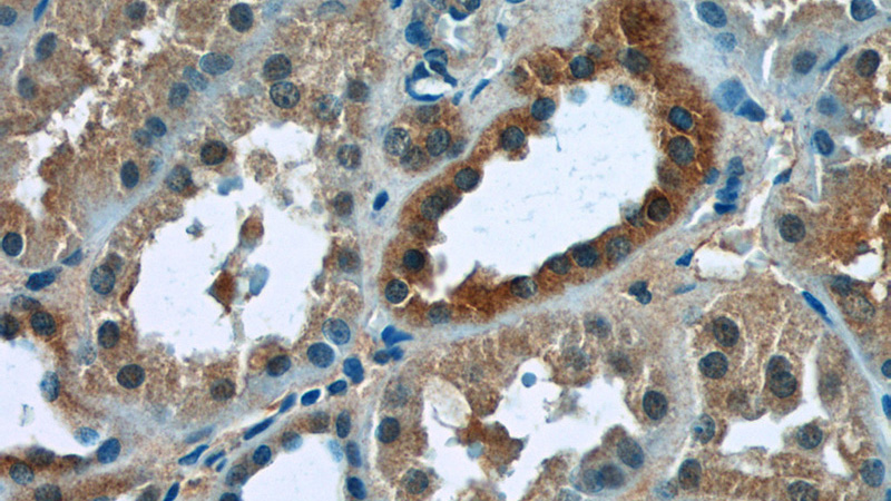 Immunohistochemistry of paraffin-embedded human kidney tissue slide using Catalog No:116998(ZNF497 Antibody) at dilution of 1:50 (under 40x lens)