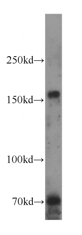 Raji cells were subjected to SDS PAGE followed by western blot with Catalog No:115667(NCOA3 antibody) at dilution of 1:500