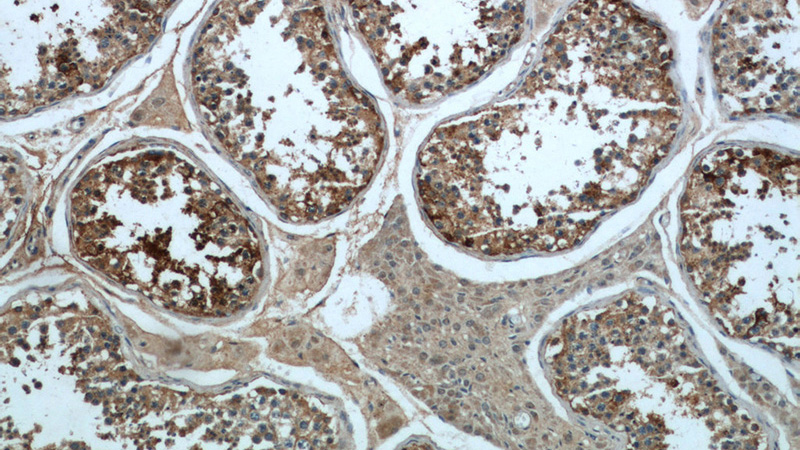 Immunohistochemical of paraffin-embedded human testis using Catalog No:115585(SRGAP1 antibody) at dilution of 1:50 (under 10x lens)