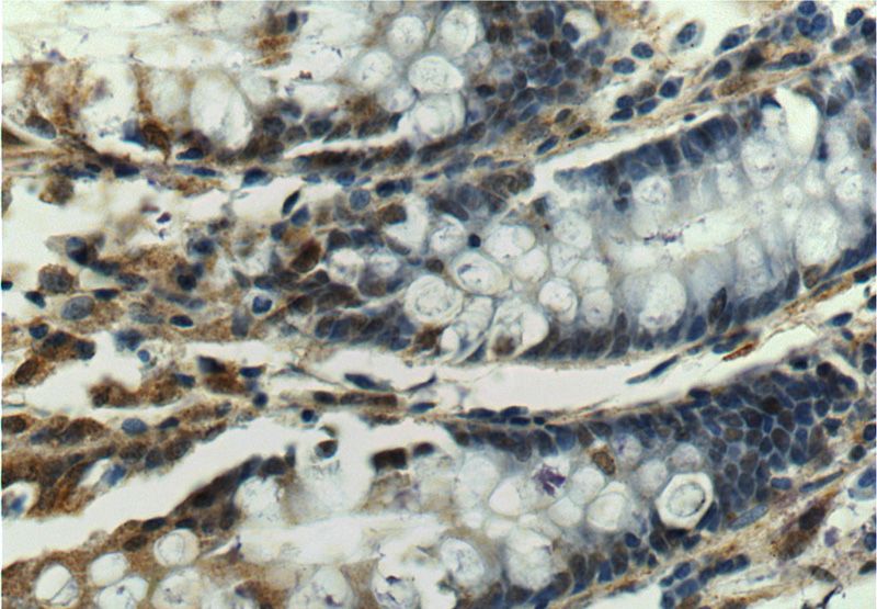 Immunohistochemistry of paraffin-embedded human colon tissue slide using Catalog No:115519(SOX7 Antibody) at dilution of 1:50 (under 40x lens)