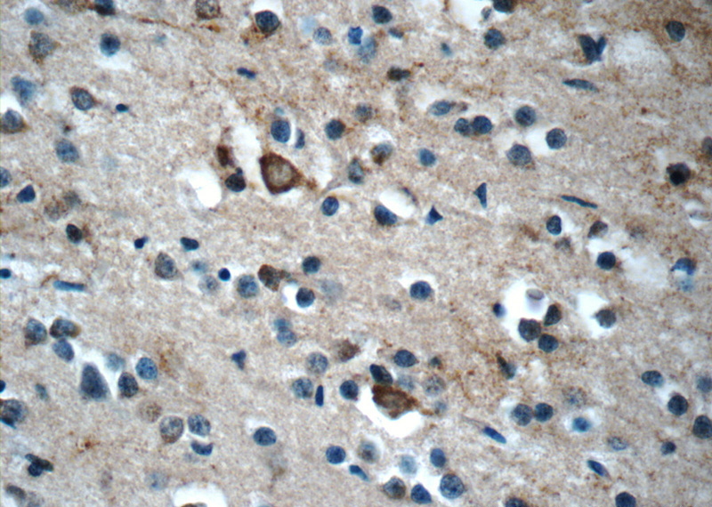 Immunohistochemistry of paraffin-embedded human brain tissue slide using Catalog No:112098(KLHL21 Antibody) at dilution of 1:50 (under 40x lens)
