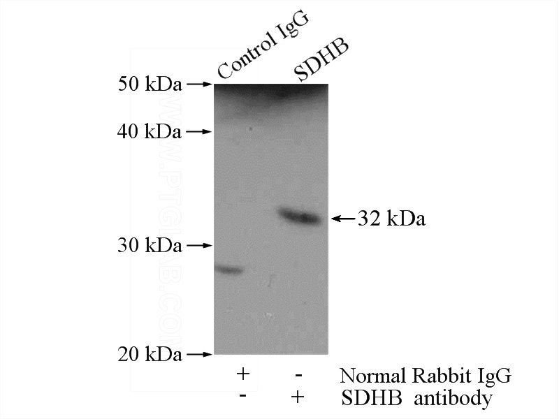 IP Result of anti-SDHB (IP:Catalog No:115032, 4ug; Detection:Catalog No:115032 1:500) with HEK-293 cells lysate 2800ug.