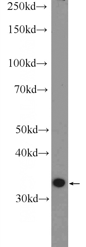 PC-3 cells were subjected to SDS PAGE followed by western blot with Catalog No:113517(OTUD6B Antibody) at dilution of 1:600