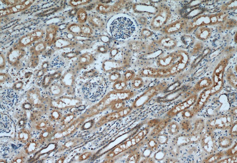 Immunohistochemical of paraffin-embedded human kidney using Catalog No:111600(IDE antibody) at dilution of 1:50 (under 10x lens)