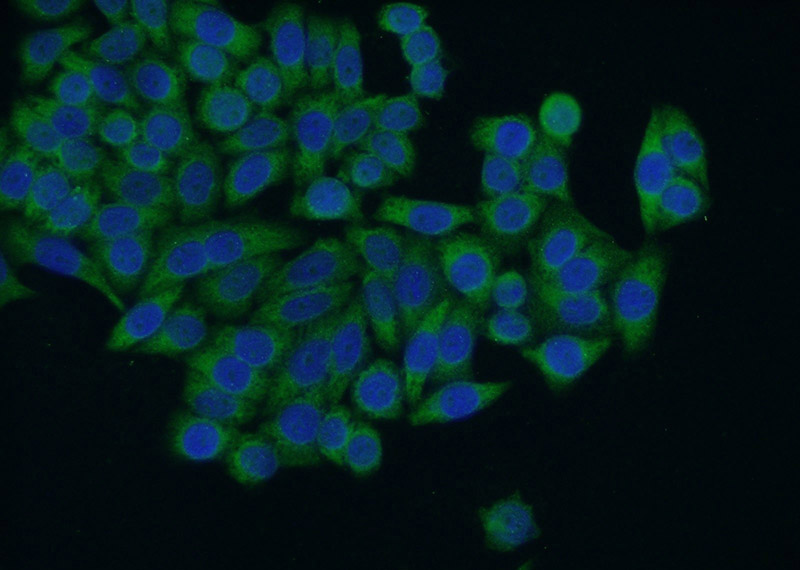 Immunofluorescent analysis of HeLa cells using Catalog No:111330(HACE1 Antibody) at dilution of 1:50 and Alexa Fluor 488-congugated AffiniPure Goat Anti-Rabbit IgG(H+L)