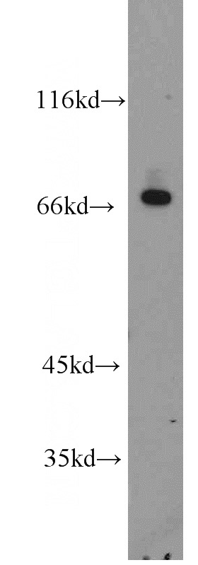 SH-SY5Y cells were subjected to SDS PAGE followed by western blot with Catalog No:117127(GLB1 antibody) at dilution of 1:400