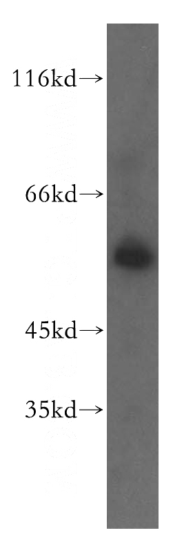 mouse brain tissue were subjected to SDS PAGE followed by western blot with Catalog No:114408(RAB11FIP2 antibody) at dilution of 1:500