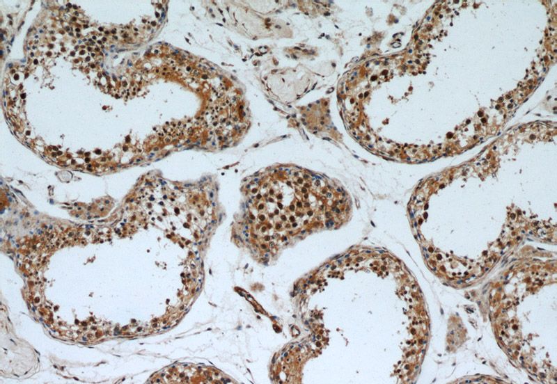 Immunohistochemical of paraffin-embedded human testis using Catalog No:109308(cIAP1 antibody) at dilution of 1:50 (under 10x lens)