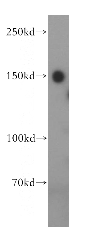 Jurkat cells were subjected to SDS PAGE followed by western blot with Catalog No:116147(TNKS antibody) at dilution of 1:500