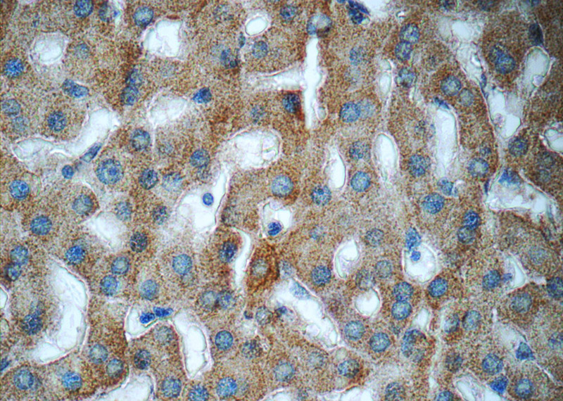 Immunohistochemistry of paraffin-embedded human liver tissue slide using Catalog No:107737(ACHE Antibody) at dilution of 1:50 (under 40x lens)