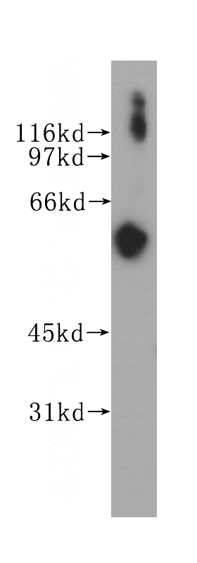 human liver tissue were subjected to SDS PAGE followed by western blot with Catalog No:113727(PEX14 antibody) at dilution of 1:500