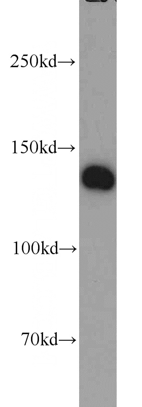 HeLa cells were subjected to SDS PAGE followed by western blot with Catalog No:110405(ERC1 antibody) at dilution of 1:1000