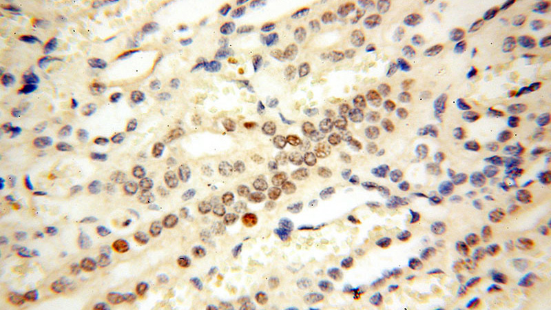 Immunohistochemical of paraffin-embedded human kidney using Catalog No:107337(NR2F6 antibody) at dilution of 1:50 (under 40x lens)