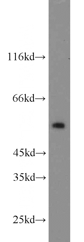 HeLa cells were subjected to SDS PAGE followed by western blot with Catalog No:111784(IMPDH1 antibody) at dilution of 1:2000