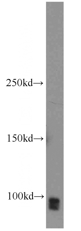 Jurkat cells were subjected to SDS PAGE followed by western blot with Catalog No:115521(SP1 antibody) at dilution of 1:500