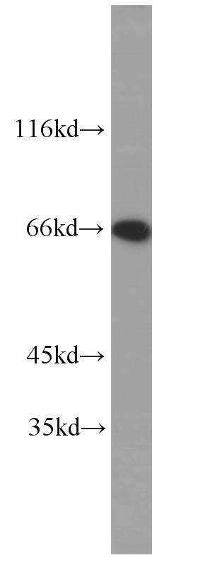 Jurkat cells were subjected to SDS PAGE followed by western blot with Catalog No:112282(LMNB2 antibody) at dilution of 1:2000