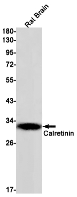 Western blot detection of Calretinin in Rat Brain lysates using Calretinin Rabbit mAb(1:1000 diluted).Predicted band size:32kDa.Observed band size:32kDa.