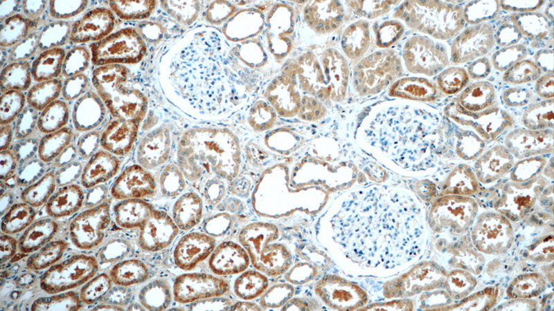 Immunohistochemistry of paraffin-embedded human kidney tissue slide using Catalog No:107700(ACSM3 Antibody) at dilution of 1:50 (under 10x lens)