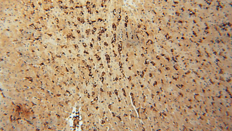 Immunohistochemical of paraffin-embedded human liver using Catalog No:111272(HBQ1 antibody) at dilution of 1:50 (under 10x lens)