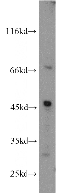 L02 cells were subjected to SDS PAGE followed by western blot with Catalog No:111319(GYG2 antibody) at dilution of 1:500