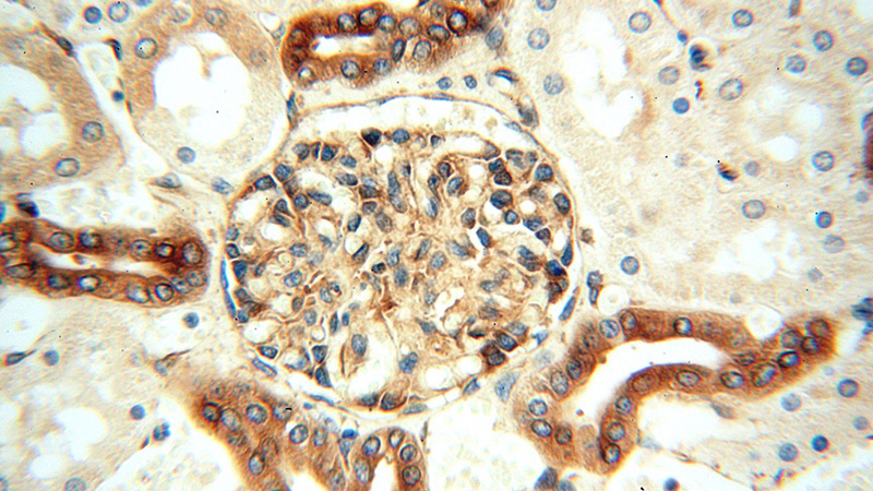 Immunohistochemical of paraffin-embedded human kidney using Catalog No:109646(CXCR7 antibody) at dilution of 1:50 (under 40x lens)