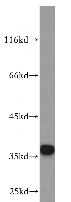 HepG2 cells were subjected to SDS PAGE followed by western blot with Catalog No:109427(CNN2 antibody) at dilution of 1:200