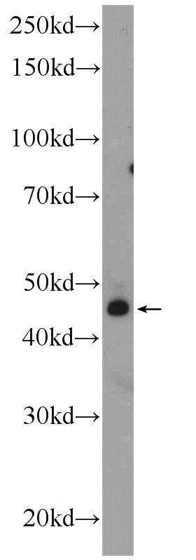 SH-SY5Y cells were subjected to SDS PAGE followed by western blot with Catalog No:116504(TWSG1 Antibody) at dilution of 1:300