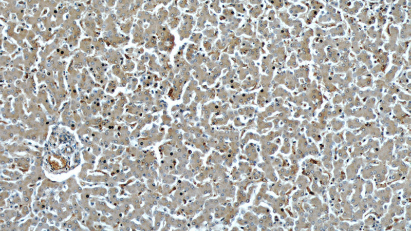 Immunohistochemical of paraffin-embedded human liver using Catalog No:113077(NDUFB8 antibody) at dilution of 1:50 (under 10x lens)