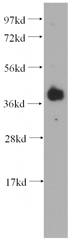 mouse brain tissue were subjected to SDS PAGE followed by western blot with Catalog No:114612(RBM4 antibody) at dilution of 1:500