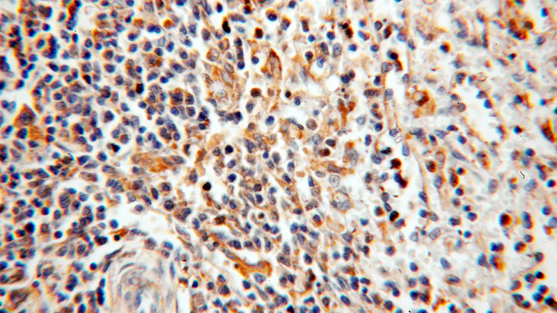 Immunohistochemical of paraffin-embedded human spleen using Catalog No:116365(TSPAN7 antibody) at dilution of 1:50 (under 40x lens)
