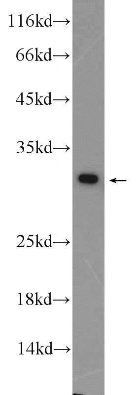 HEK-293 cells were subjected to SDS PAGE followed by western blot with Catalog No:109749(DCI Antibody) at dilution of 1:600