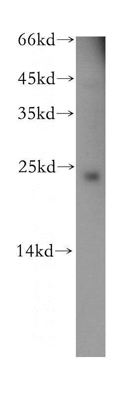 human brain tissue were subjected to SDS PAGE followed by western blot with Catalog No:109250(CEND1 antibody) at dilution of 1:300