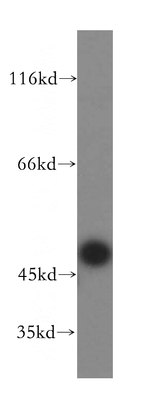 HEK-293 cells were subjected to SDS PAGE followed by western blot with Catalog No:115856(TASP1 antibody) at dilution of 1:500